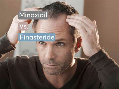 finasteride and minoxidil for hair loss